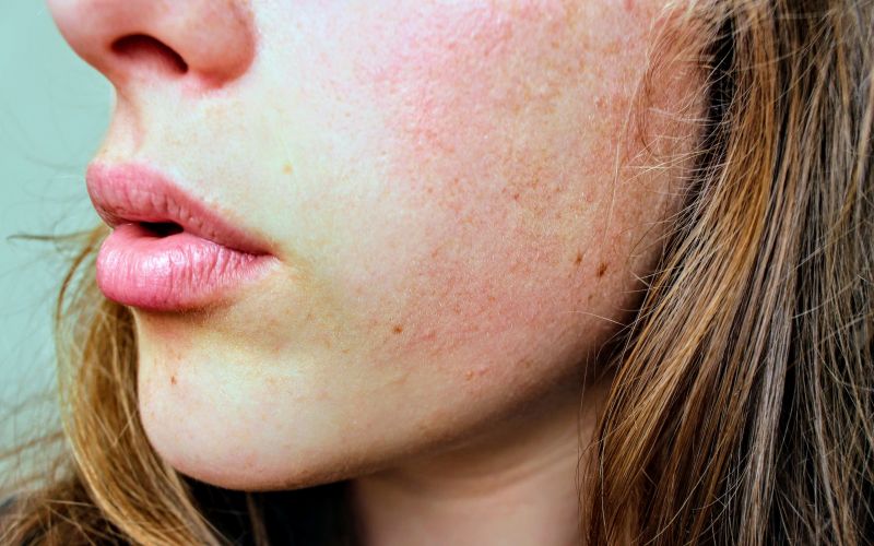 Những điều nên biết về thải độc da